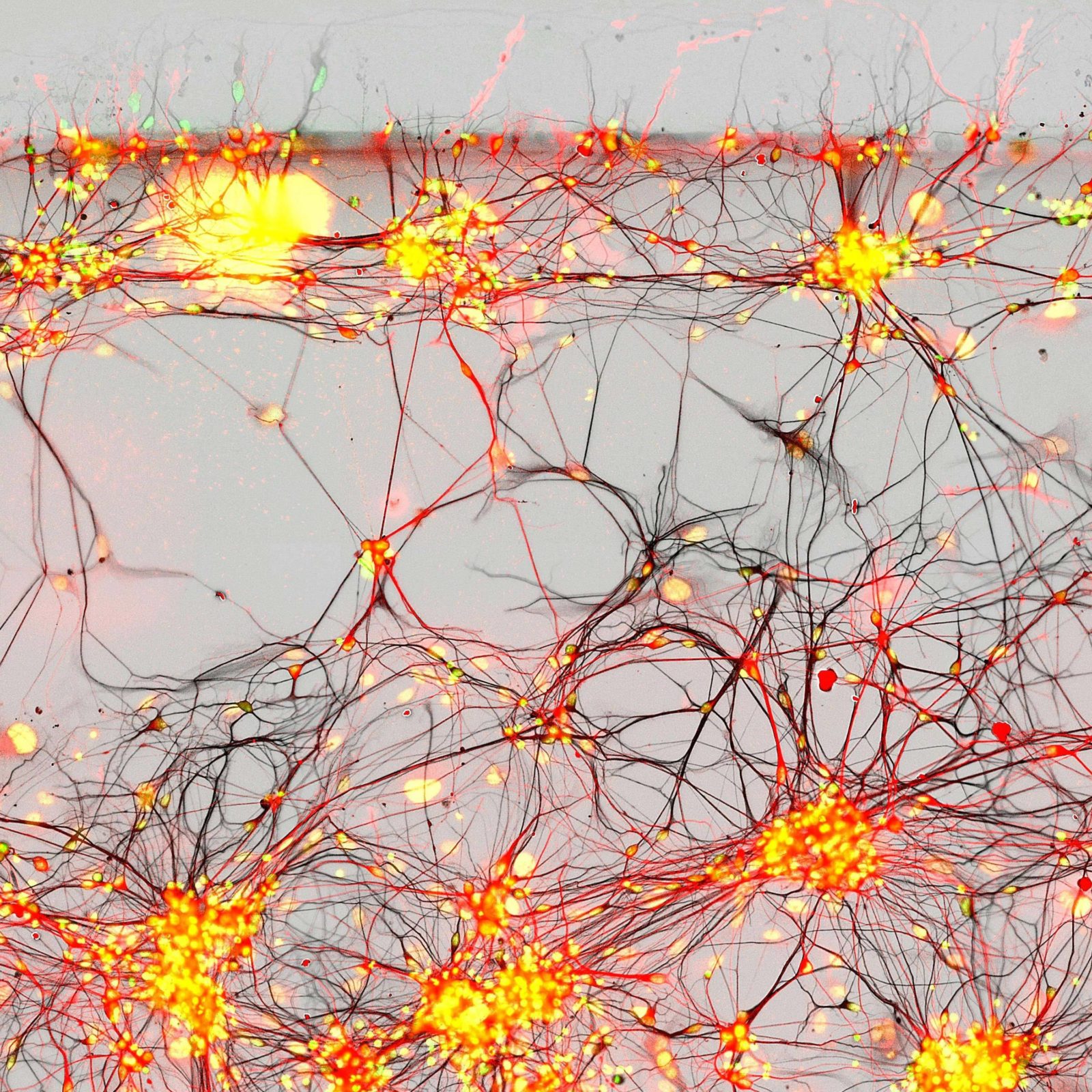 Нейросеть для оригинальности текста. Нейронные сети головного мозга. Нейрон в нейронной сети. Нейросеть Нейроны. Нейрон Пуанкаре микрофотография.